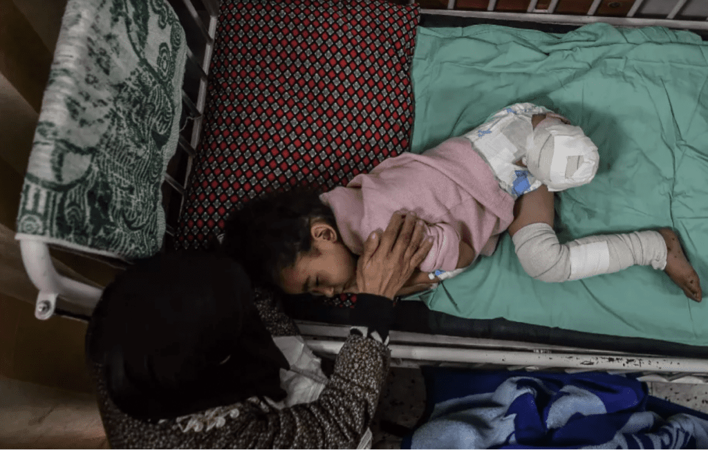 More than 9,000 children in Gaza have undergone amputation, in many ...